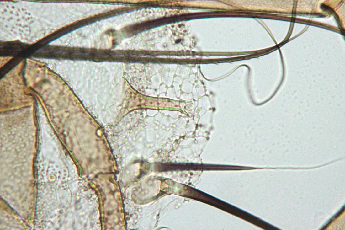 Anonyme - Damaeus (Paradamaeus) clavipes - réf. 109728 (1100 x 733 pixels, 161 ko)