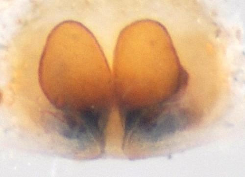 Tibellus oblongus