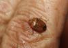 110126 – Photo : alain Roujas – France (31)