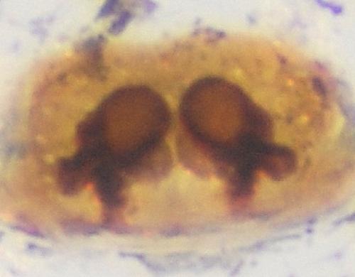 Trichopterna cucurbitina
