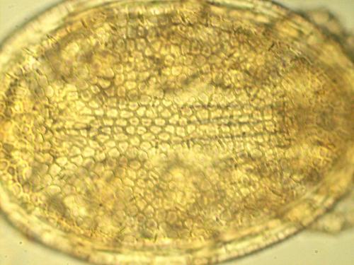Uroobovella pulchella