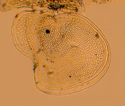Balloniscus sp.