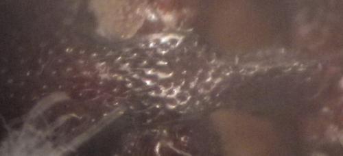 Brachygonus bouyoni