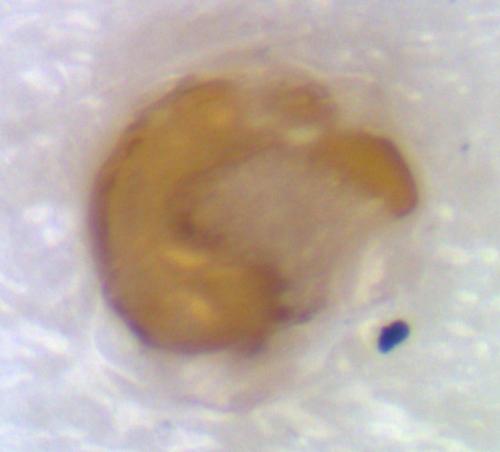 Hexarthrum capitulum