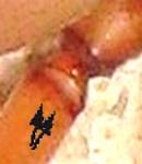 Dysdera crocata