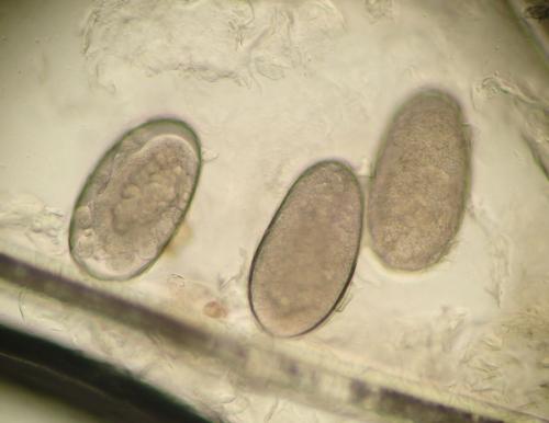 Réf. 151 793 : Sarcoptes scabiei