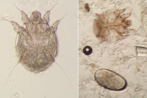 Réf. 151 833 : Sarcoptes scabiei