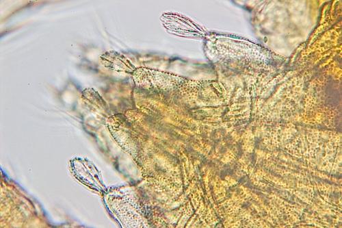 Réf. 152 876 : Bryobia praetiosa