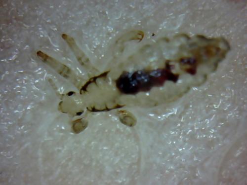 Pediculus humanus