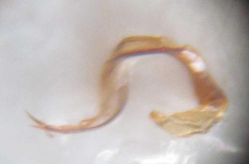 Plagiognathus bipunctatus