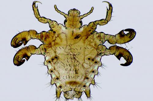 Pthirus pubis