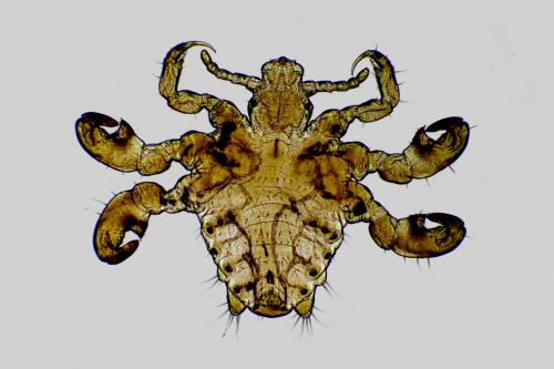 Pthirus pubis
