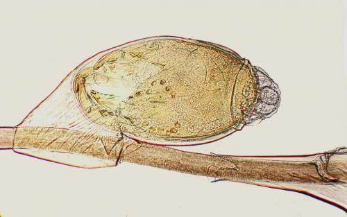 Pthirus pubis