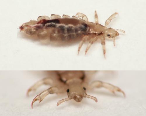Réf. 17 239 : Pediculus capitis