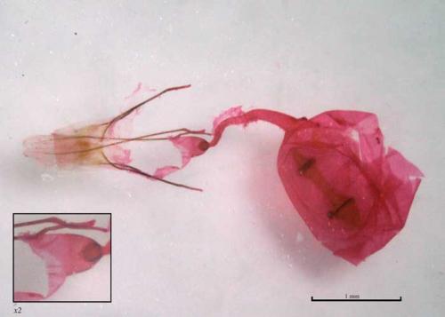 Ypsolopha sylvella