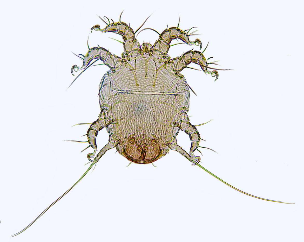 Réf. 175188 — ARACHNIDA > Astigmata > Chaetodactylidae > Chaetodactylus