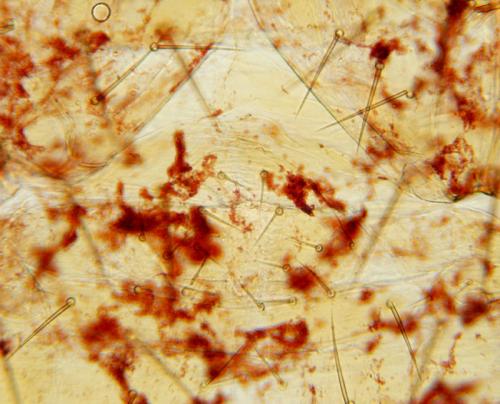 Chthonius ischnocheles