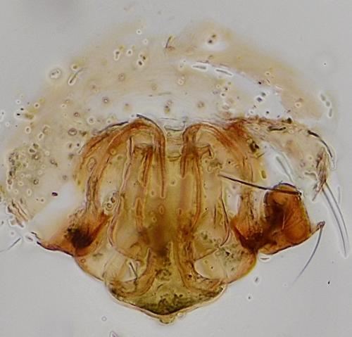 Réf. 177 075 : Tenuiphantes zimmermanni