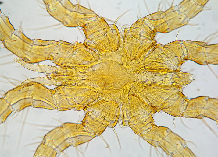 Anonyme - Spinturnix myoti - réf. 178240 (715 x 516 pixels, 202 ko)