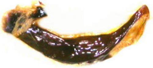 Réf. 19 703 : Carabus variolosus