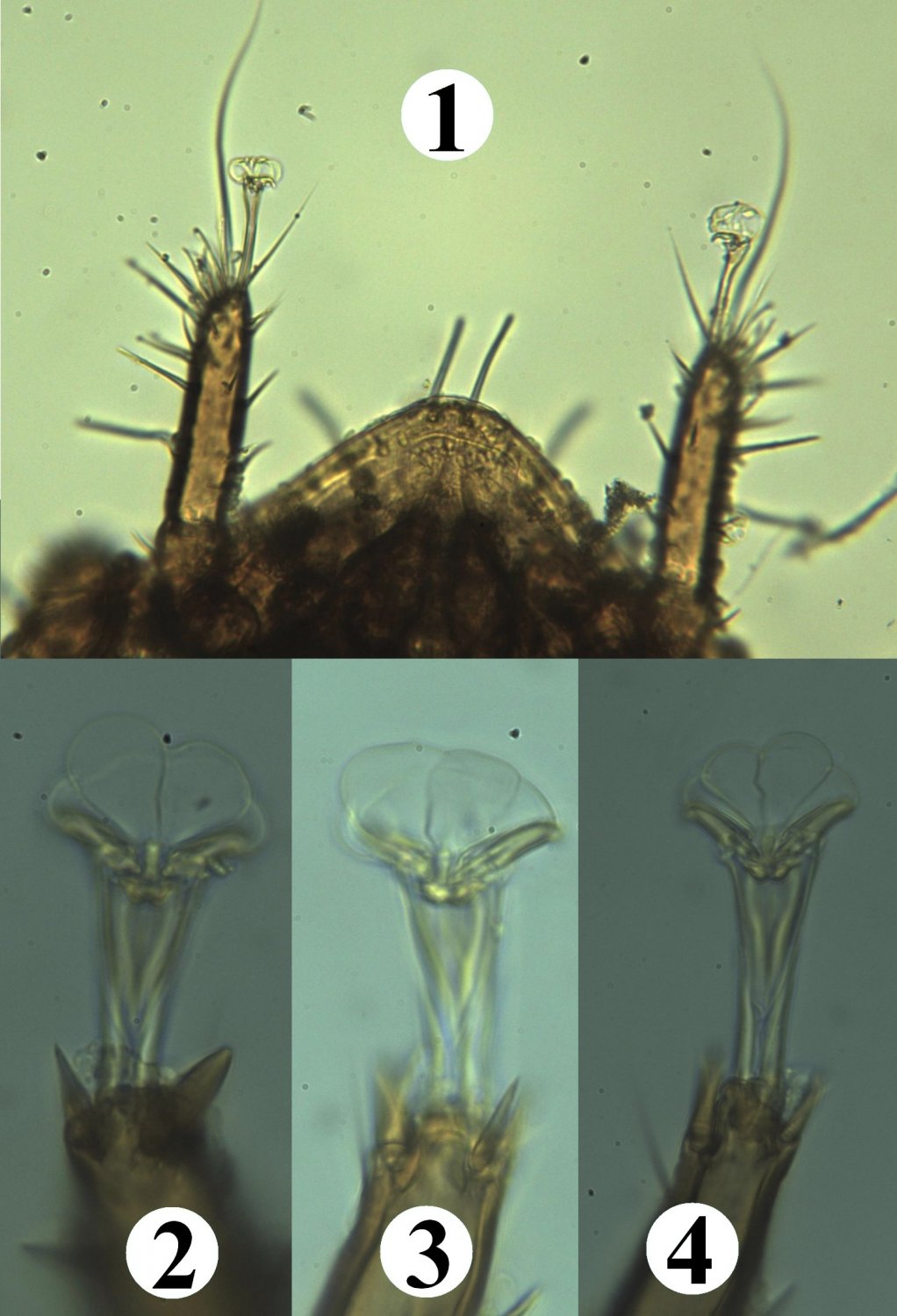 Jean Claude Lutrand - Trichouropoda obscura - réf. 201273 (1022 x 1500 pixels, 158 ko)