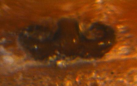 Réf. 241 222 : Hypsosinga sanguinea
