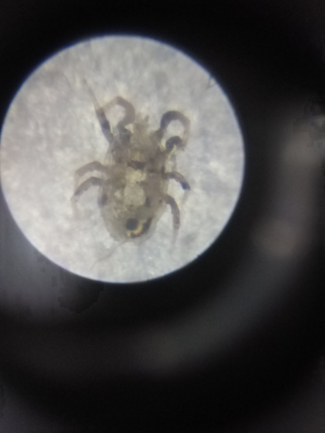 Fabienbis - Dermatophagoides pteronyssinus - réf. 263012 (1125 x 1500 pixels, 94 ko)