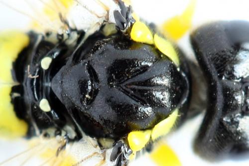 Zonuledo zonula