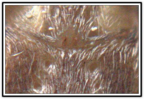 Philodromus sp.
