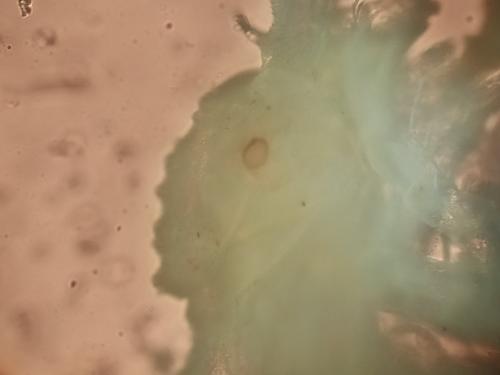 Trichoniscoides sp.