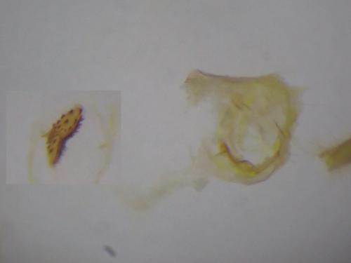 Réf. 279 202 : Depressaria albipunctella