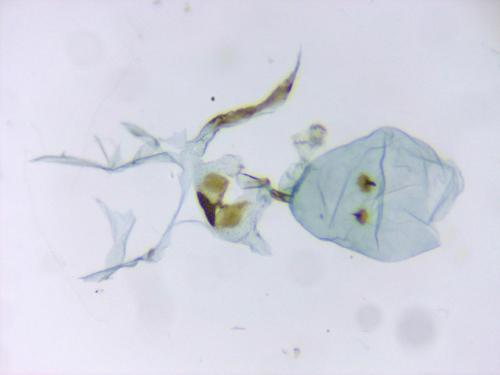 Pammene juniperana