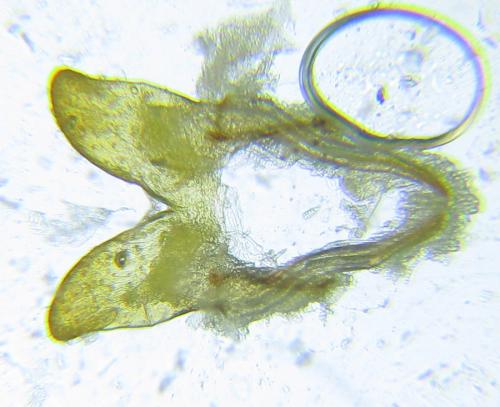 Cephalcia arvensis