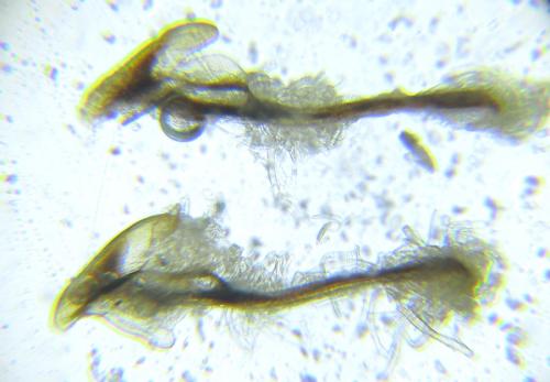 Zonuledo zonula