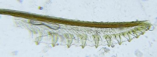 Zonuledo zonula