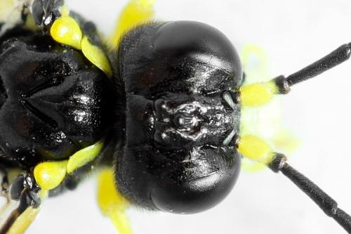 Zonuledo zonula