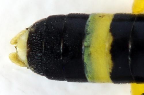 Zonuledo zonula