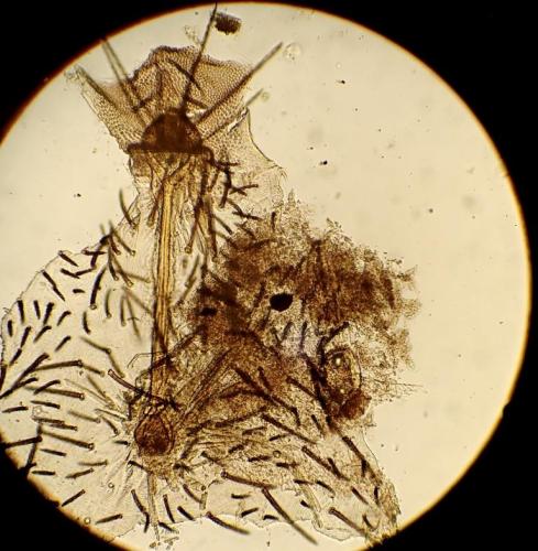 Erythraeus cinereus