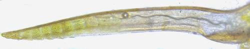 Strongylogaster baikalensis