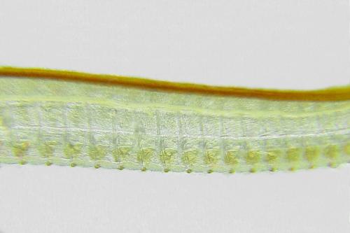 Trichiosoma vitellina