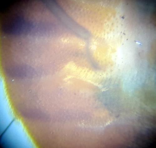 Cimex lectularius