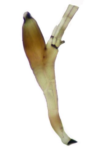 Indéterminé