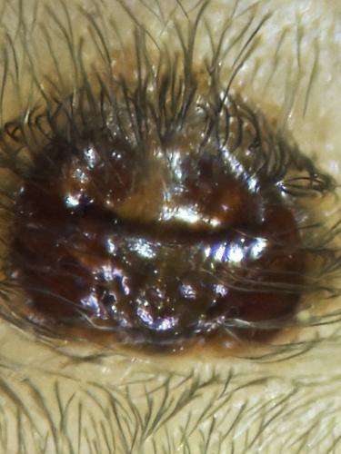 Réf. 345 861 : Cheiracanthium mildei
