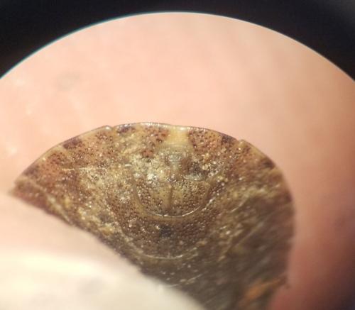 Sciocoris microphthalmus