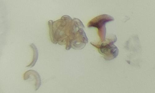 Acrotrichis sp.