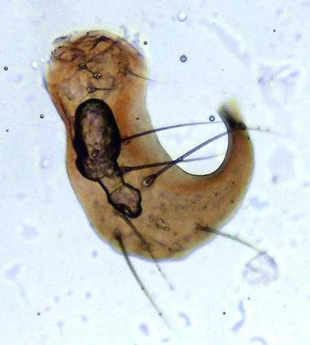 Bathyphantes gracilis
