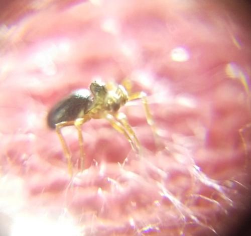 Réf. 354 939 : Pelecopsis elongata