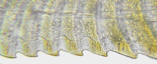 Euura humeralis