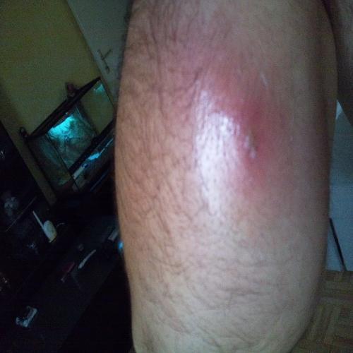 quel insecte suis je