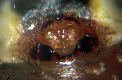 Labulla thoracica